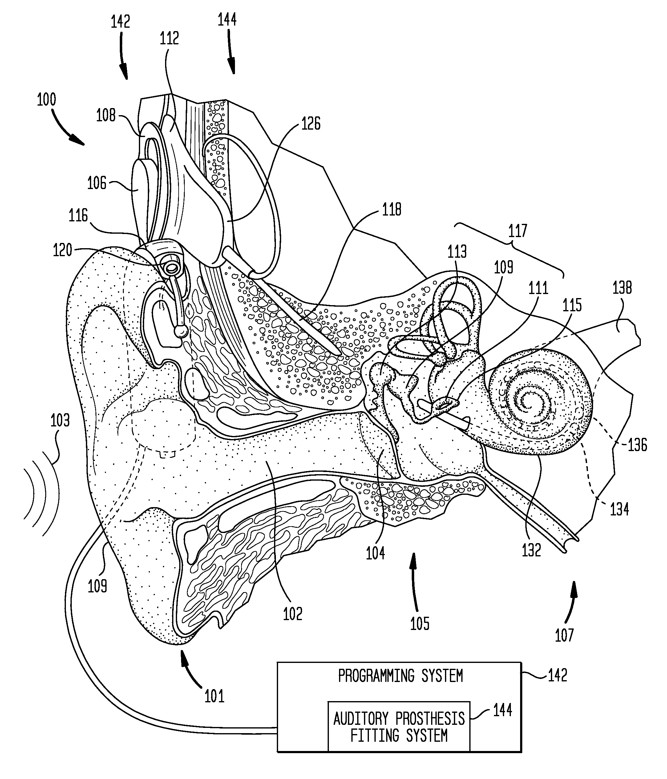 Method and device for automated observation fitting