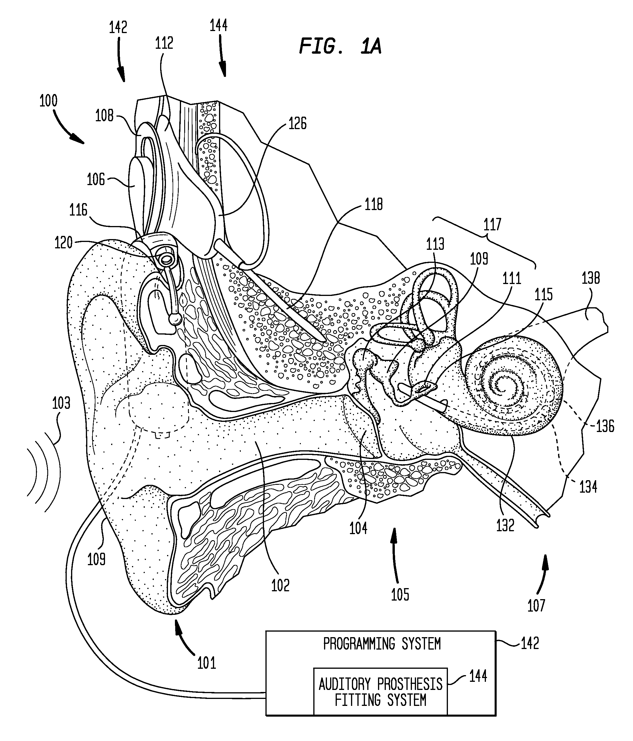 Method and device for automated observation fitting