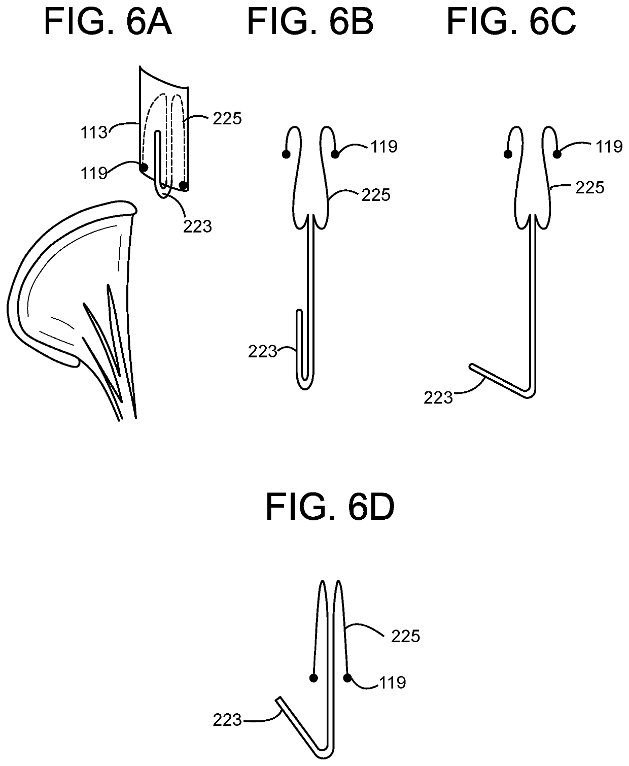 A2 Clip for Side-Delivered Transcatheter Mitral Valve Prosthesis