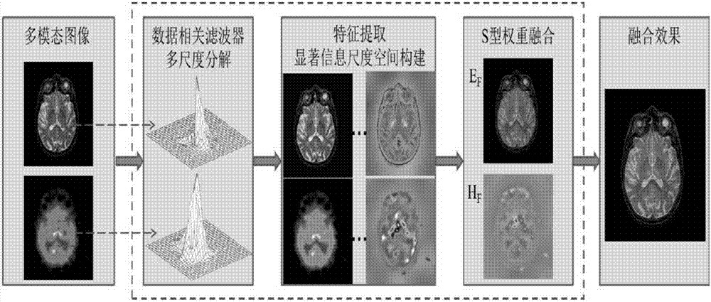 Multi-modal medical image fusion method based on multi-scale anisotropic decomposition and low-rank analysis