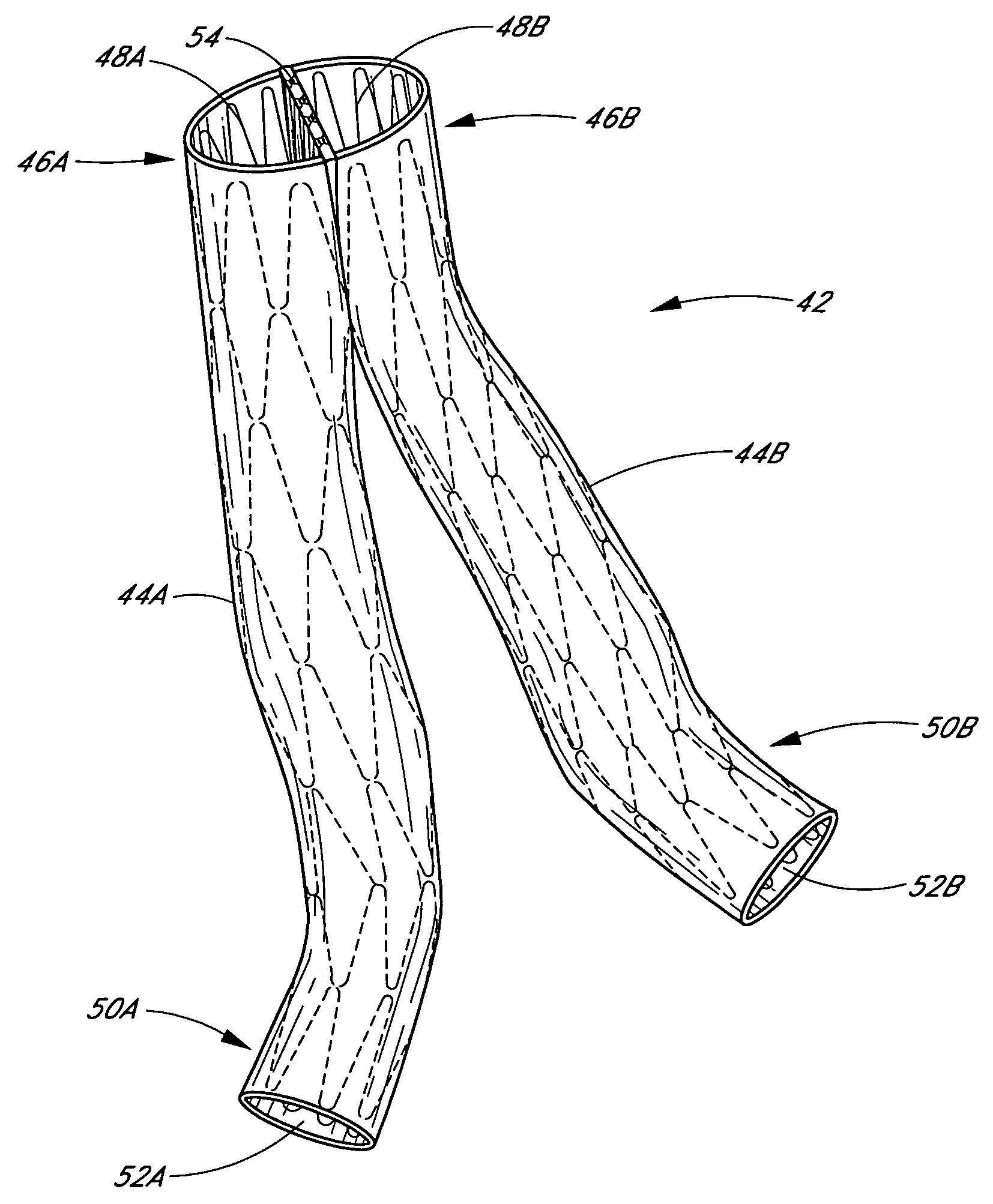 Vascular graft and deployment system