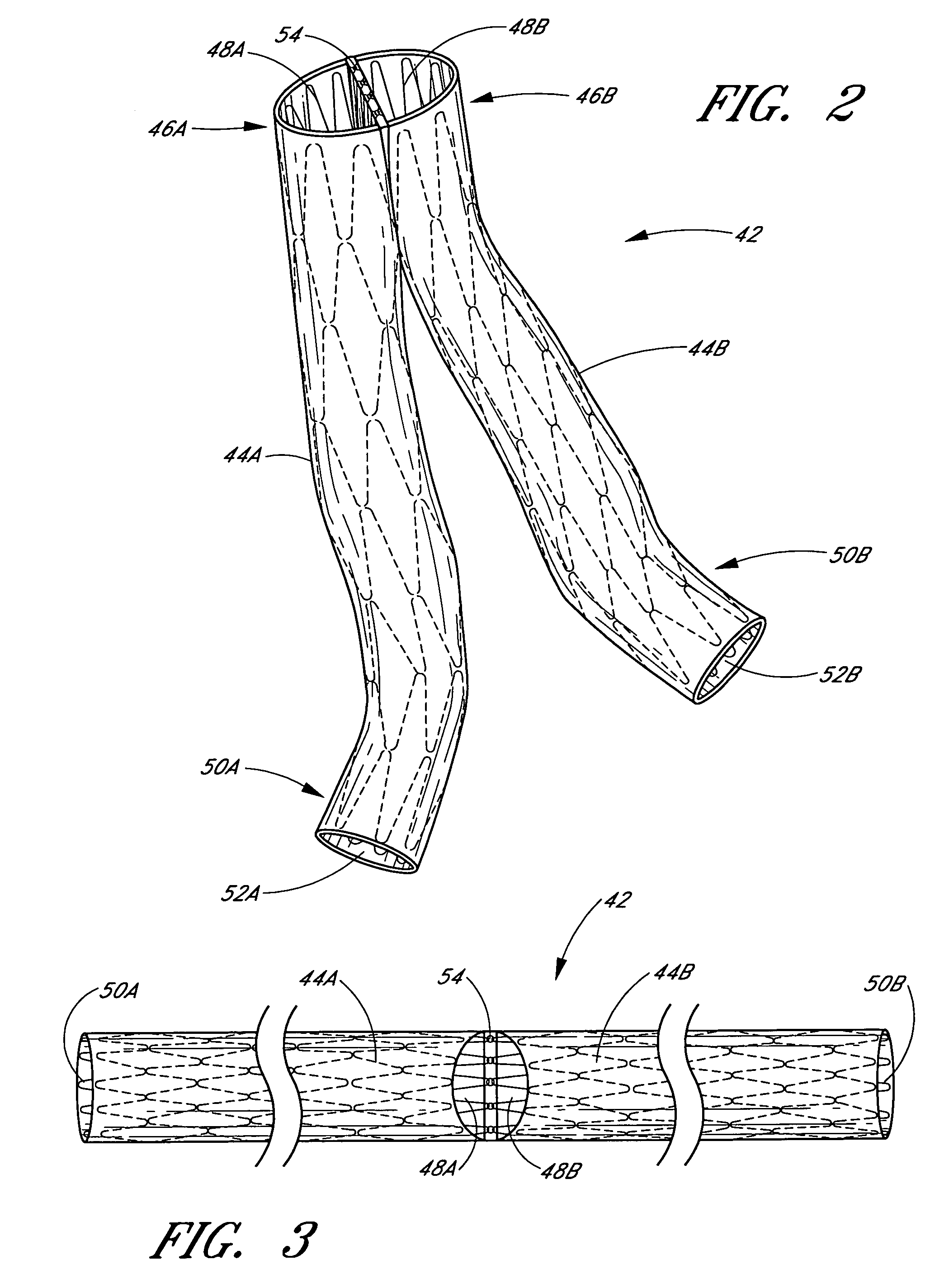 Vascular graft and deployment system