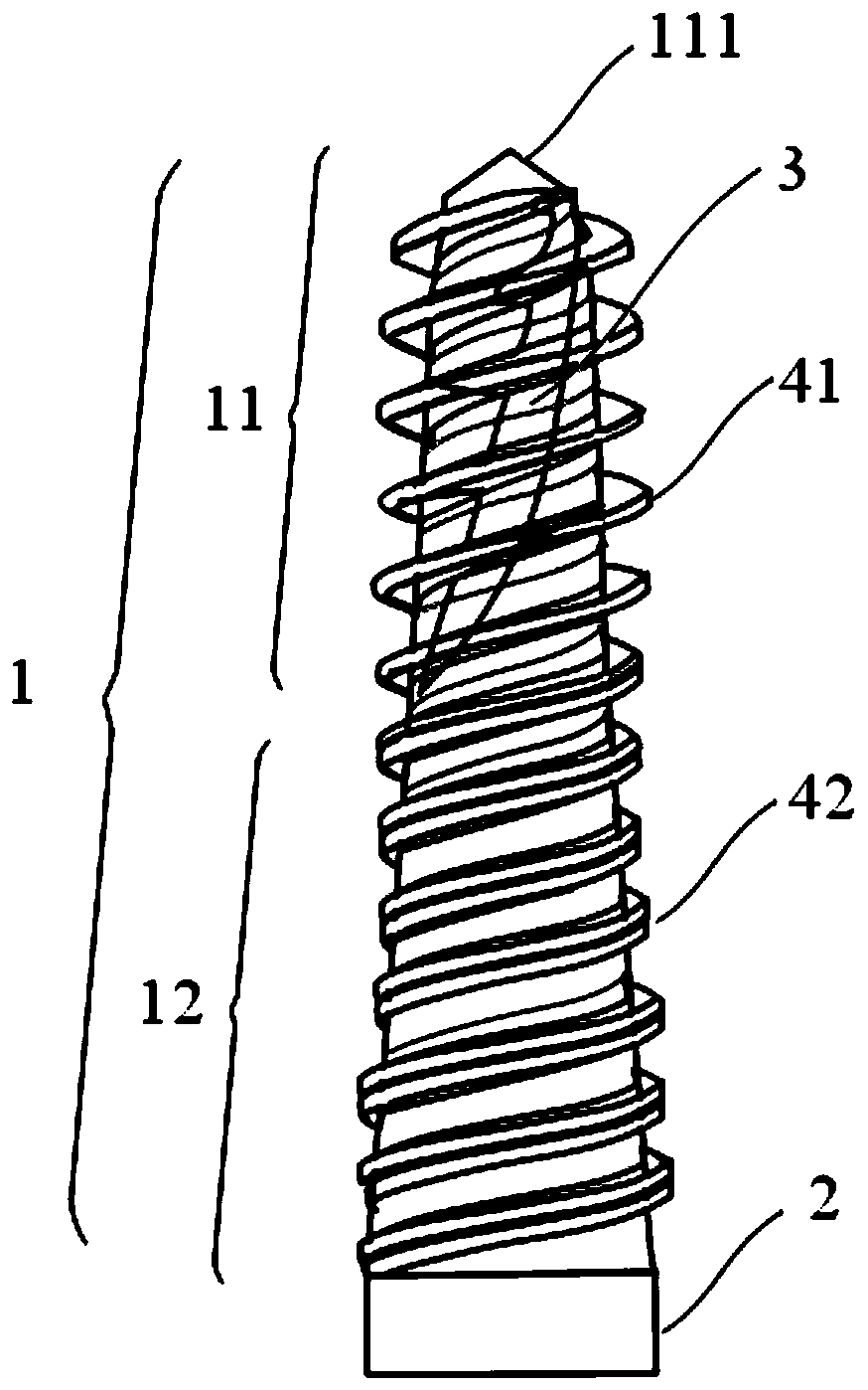 Pterygoid plate-penetrating plate implant and oral implant