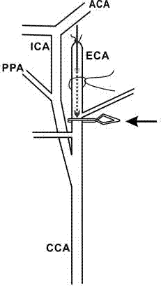 Novel subarachnoid hemorrhage model manufacturing method