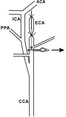 Novel subarachnoid hemorrhage model manufacturing method