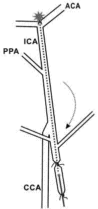 Novel subarachnoid hemorrhage model manufacturing method