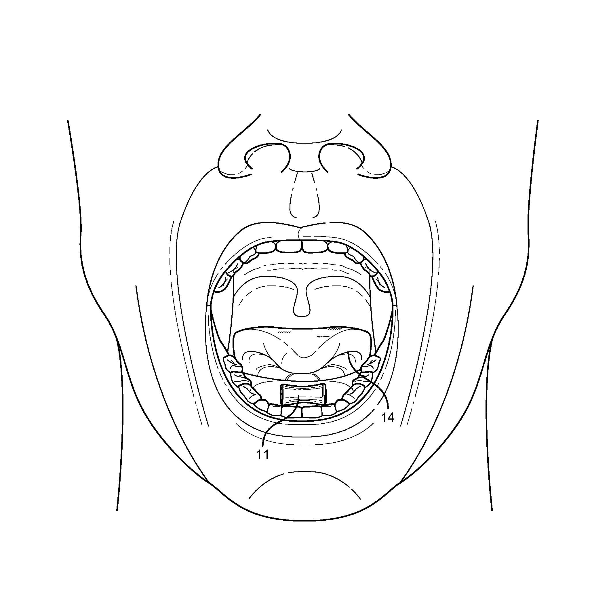 Orally ingested metabolic enhancer in oral thin film container