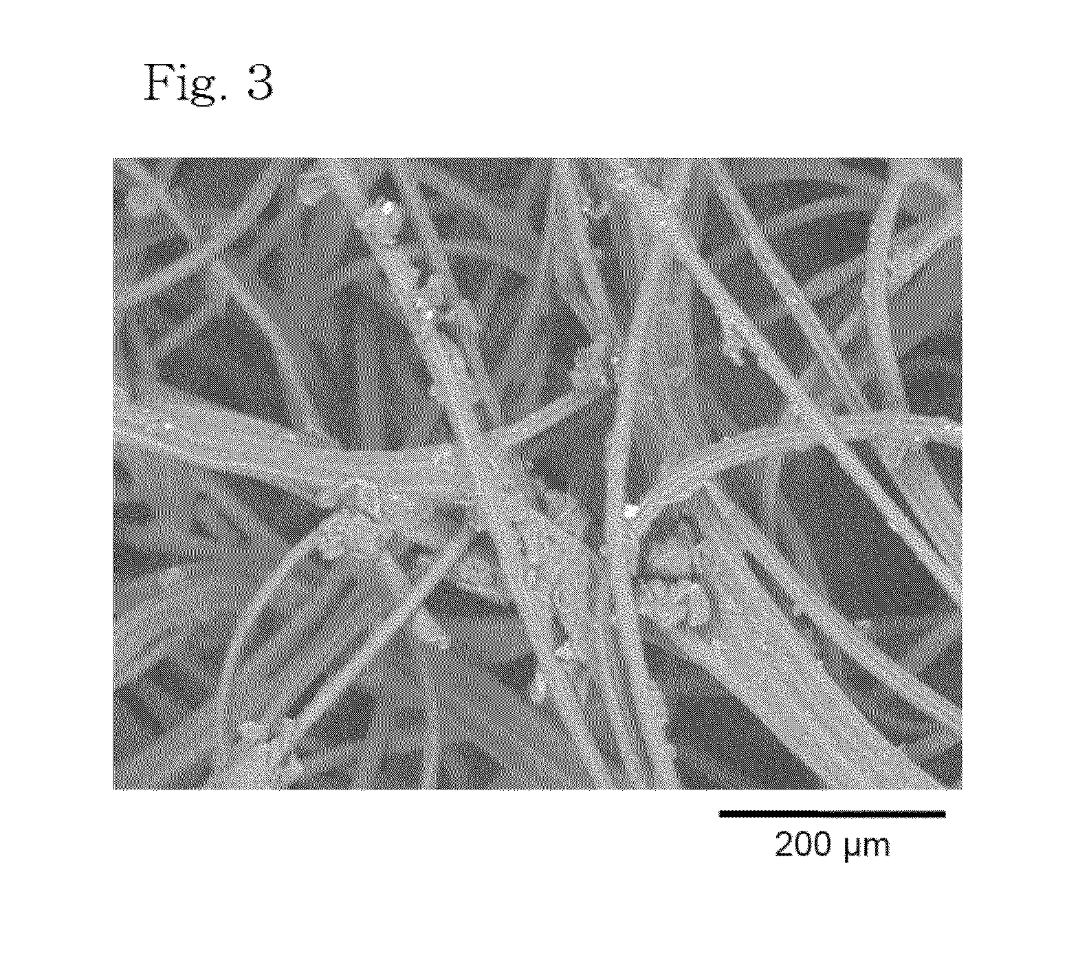 Metal-adsorbing gel and adsorbent supporting metal-adsorbing gel