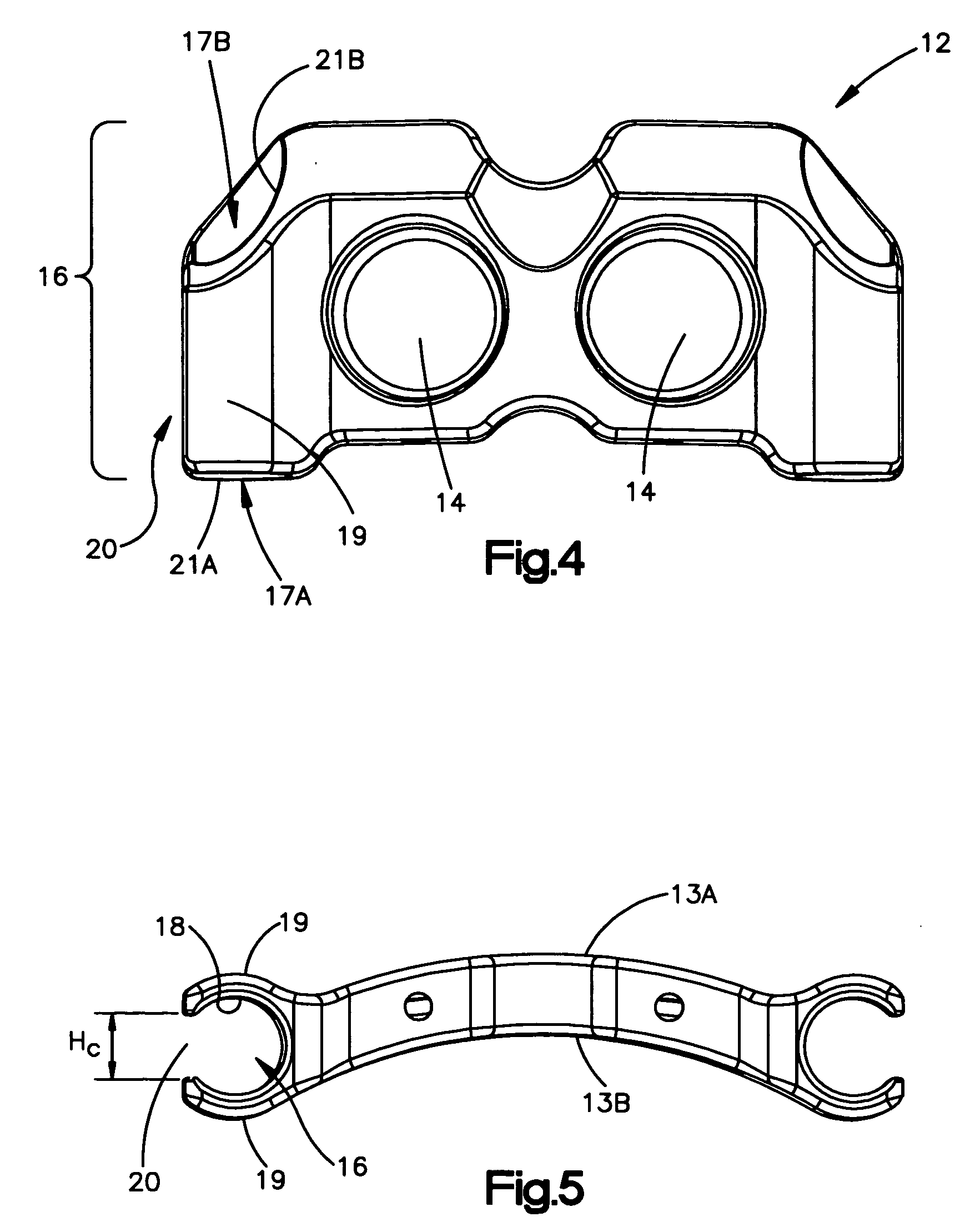 Unidirectional fixation device