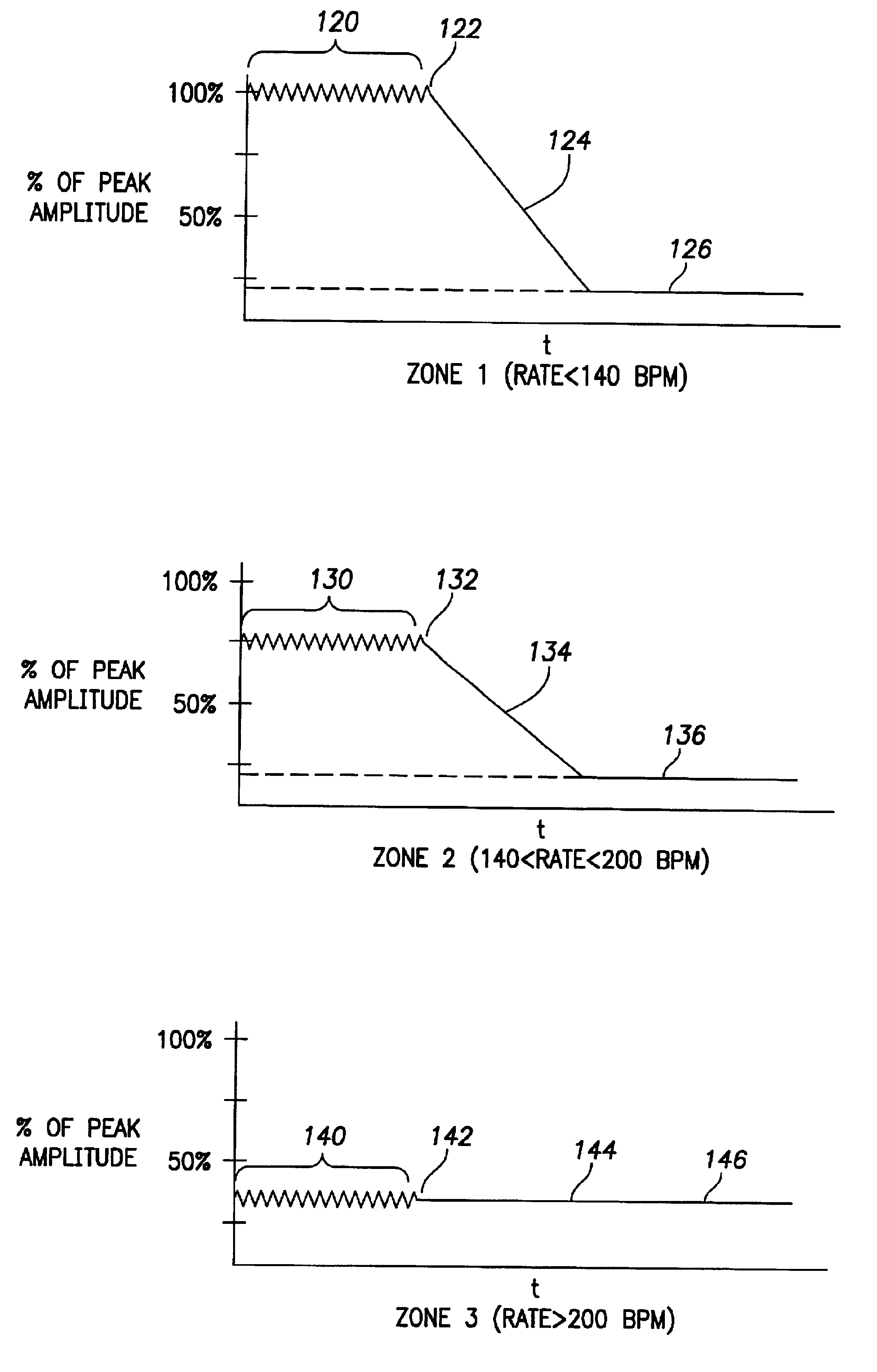 Implantable cardiac stimulation device having automatic sensitivity control and method