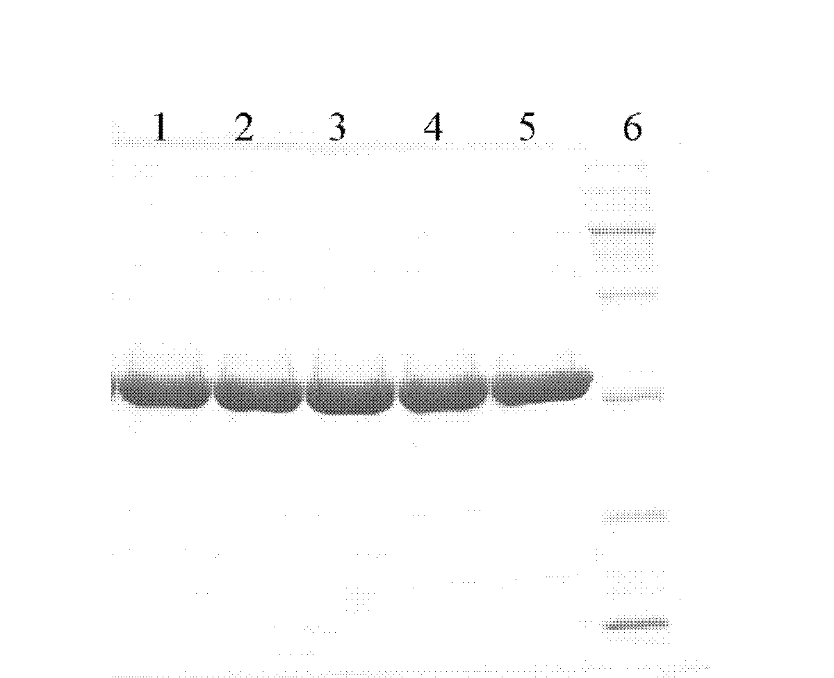 Human urate oxidase protein and preparation method and polyethylene glycol composite thereof