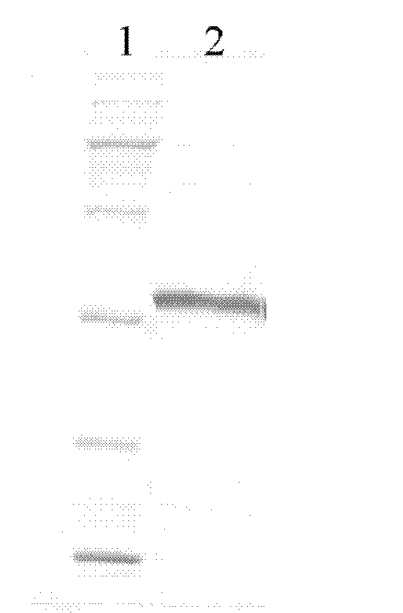 Human urate oxidase protein and preparation method and polyethylene glycol composite thereof