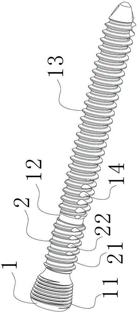 Micro-motion locking screw