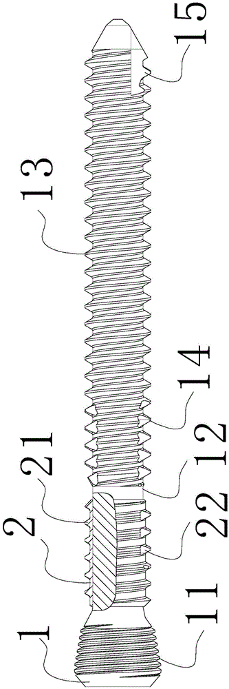 Micro-motion locking screw