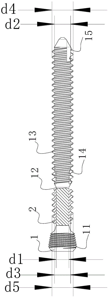 Micro-motion locking screw