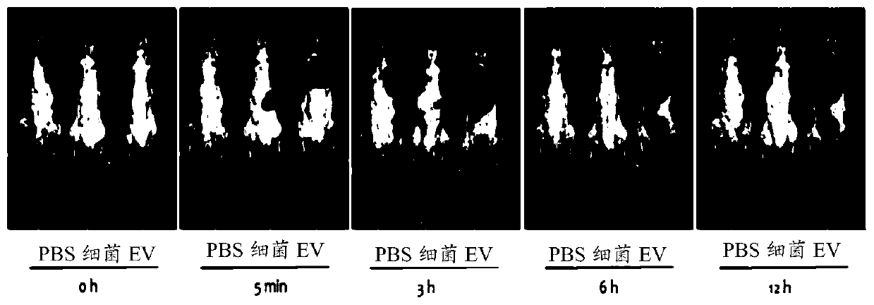 Nanovesicles derived from genus bacillus bacteria and use thereof