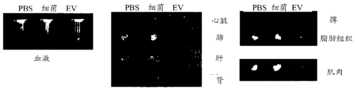 Nanovesicles derived from genus bacillus bacteria and use thereof