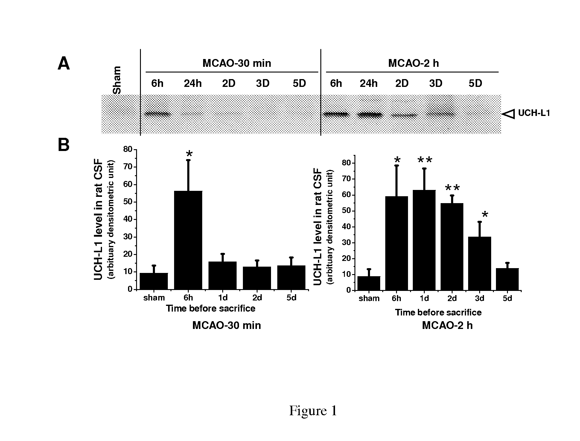 Biomarker detection process and assay of neurological condition