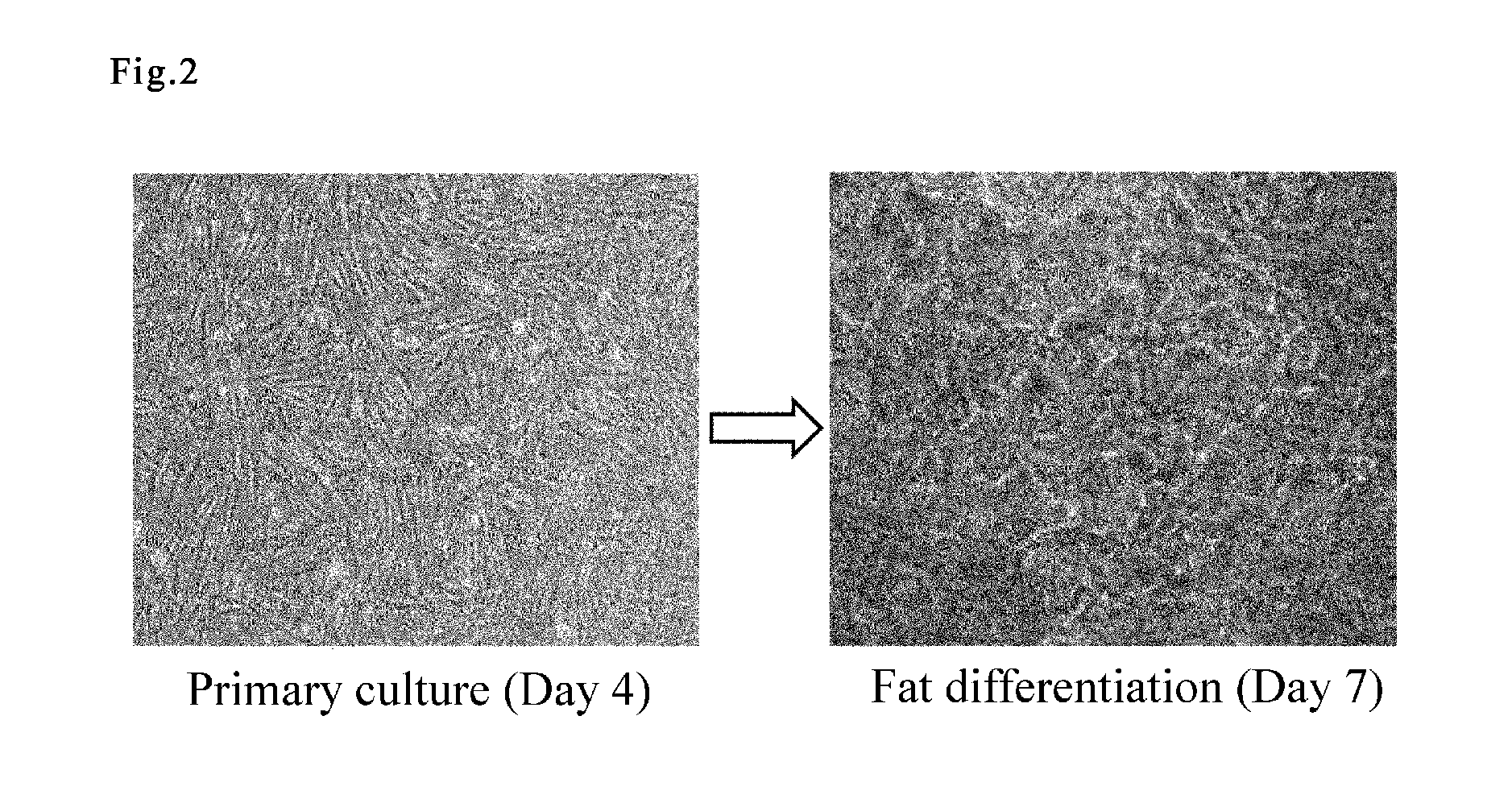 Cell preparation for erectile dysfunction or sensory disorders of the lower urinary tract containing adipose tissue derived mesenchymal stem cells