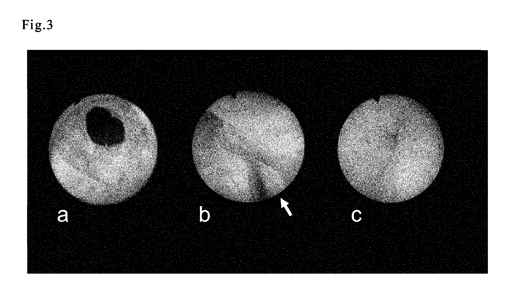 Cell preparation for erectile dysfunction or sensory disorders of the lower urinary tract containing adipose tissue derived mesenchymal stem cells