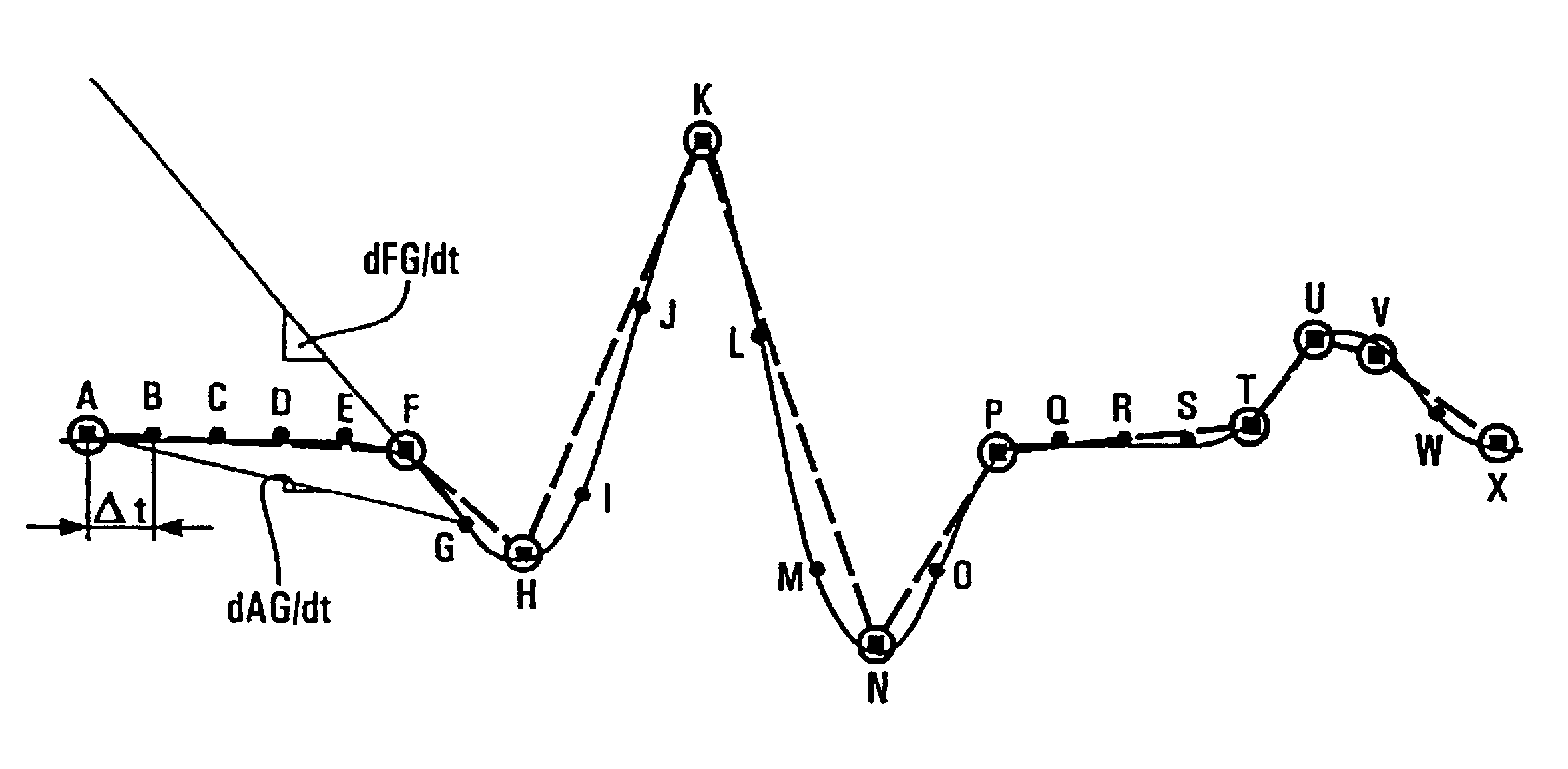 Method and apparatus for storing signals in an implantable medical device