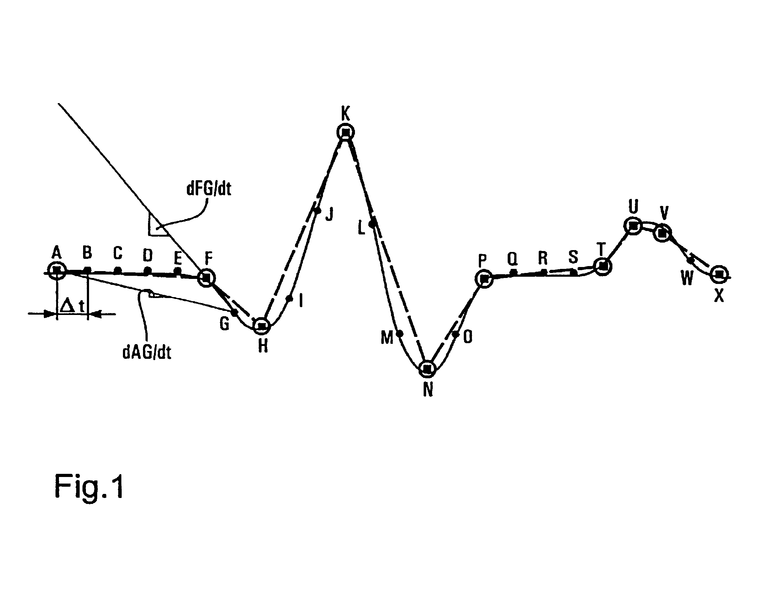 Method and apparatus for storing signals in an implantable medical device