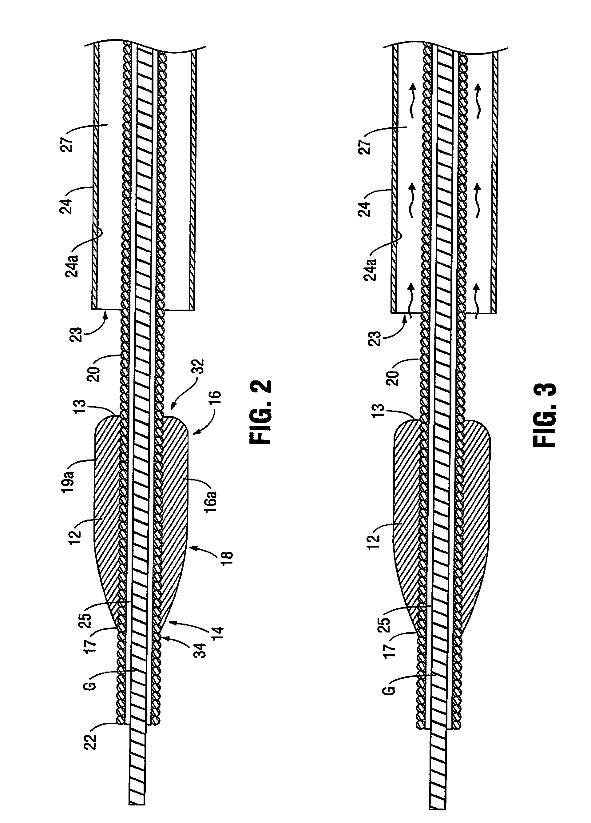 Artherectomy device