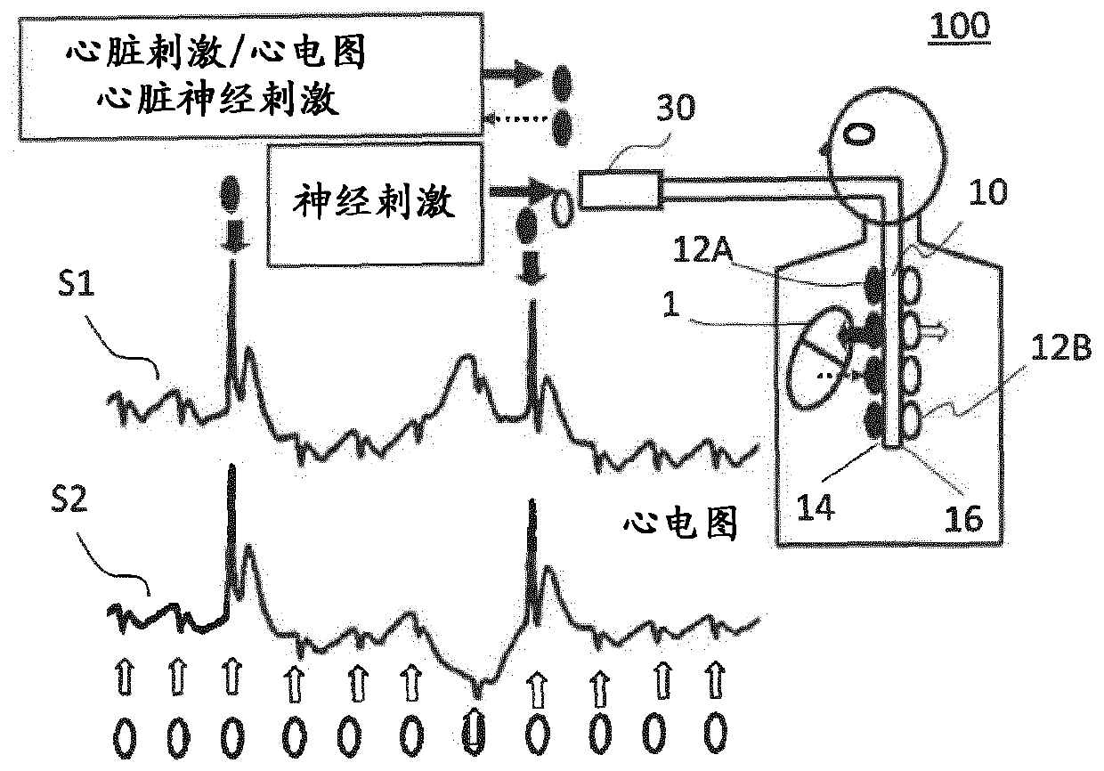 Oesophageal electrode probe and device for cardiological treatment and/or diagnosis