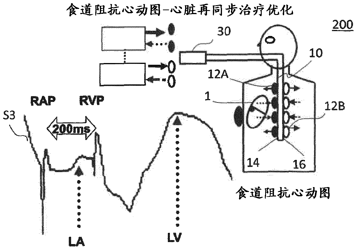 Oesophageal electrode probe and device for cardiological treatment and/or diagnosis