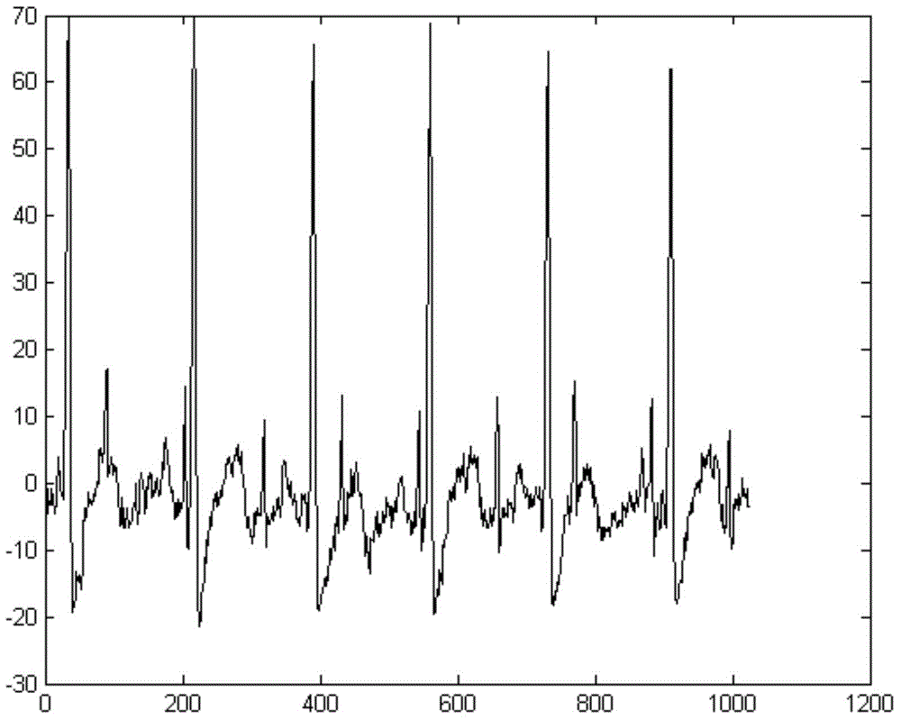 Fetal electrocardiogram instantaneous heart rate recognition method and system based on non-negative blind separation