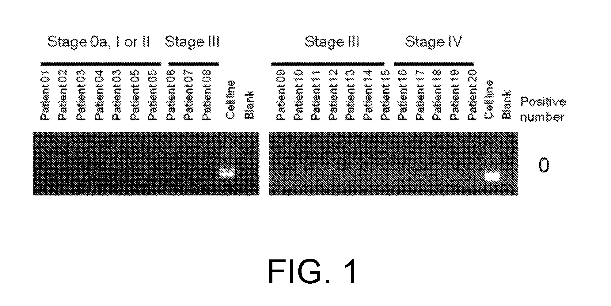 Fgfr3 fusion gene and pharmaceutical drug targeting same