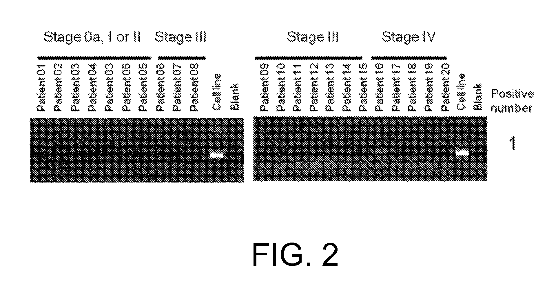 Fgfr3 fusion gene and pharmaceutical drug targeting same