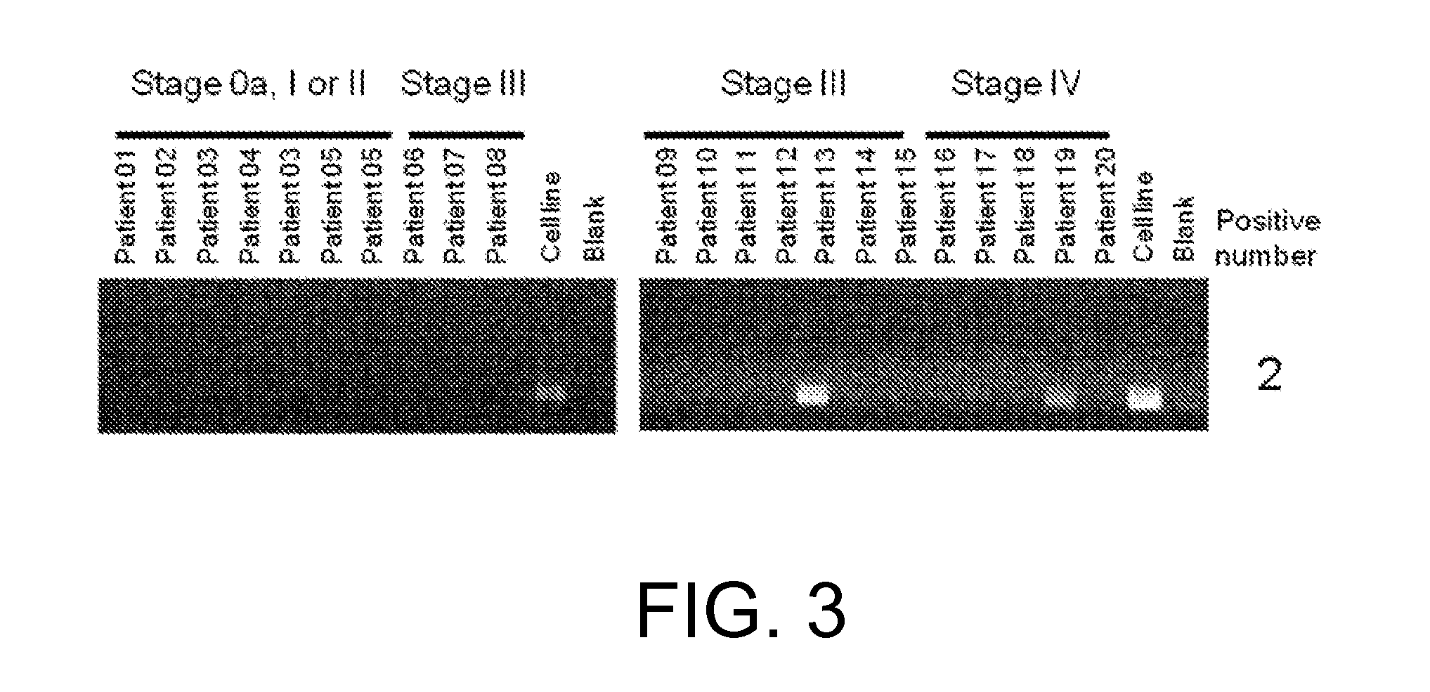 Fgfr3 fusion gene and pharmaceutical drug targeting same