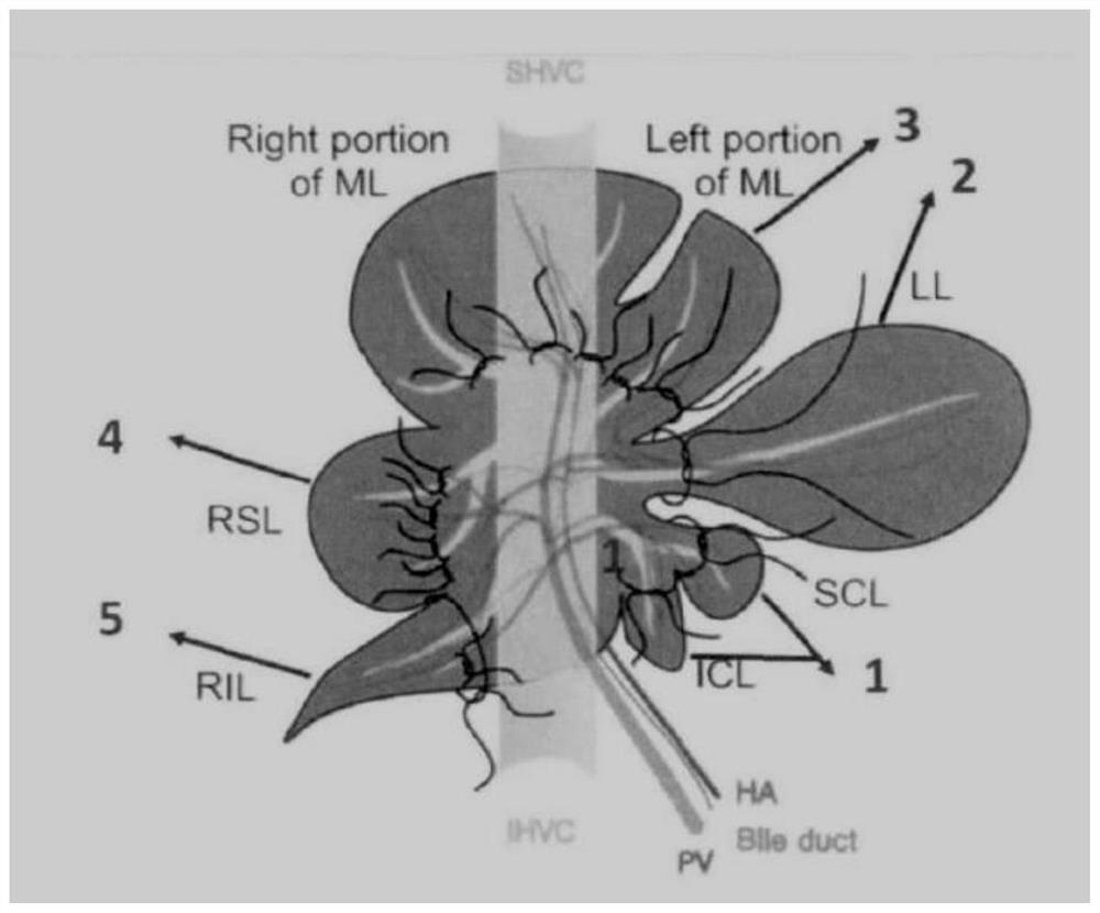 Application of lactobacillus plantarum in promoting liver regeneration