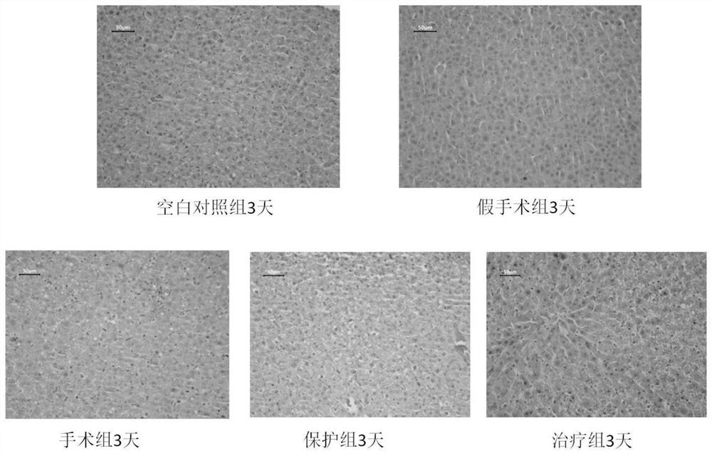 Application of lactobacillus plantarum in promoting liver regeneration