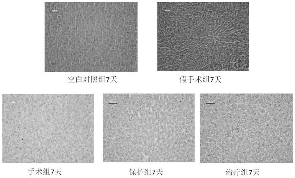 Application of lactobacillus plantarum in promoting liver regeneration