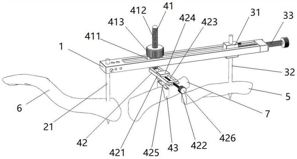 Clavicle fracture closed reduction device and method