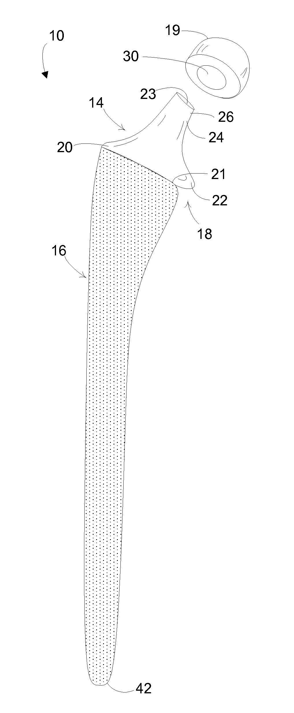 Hip implant with porous body