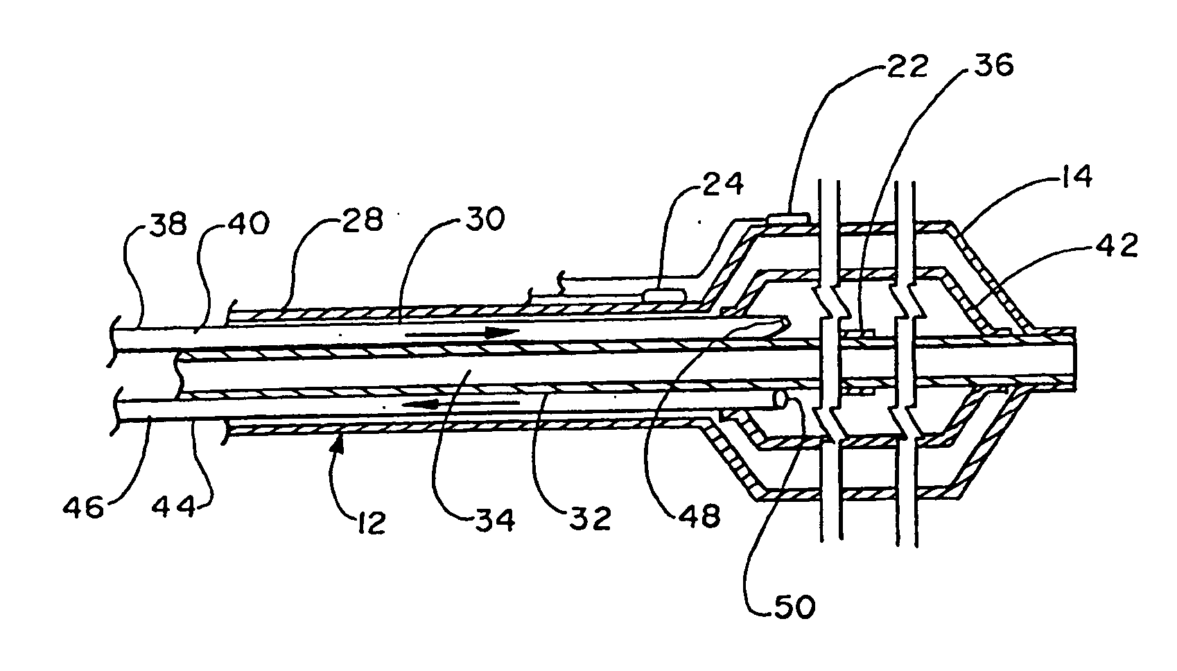 Cryoplasty device and method