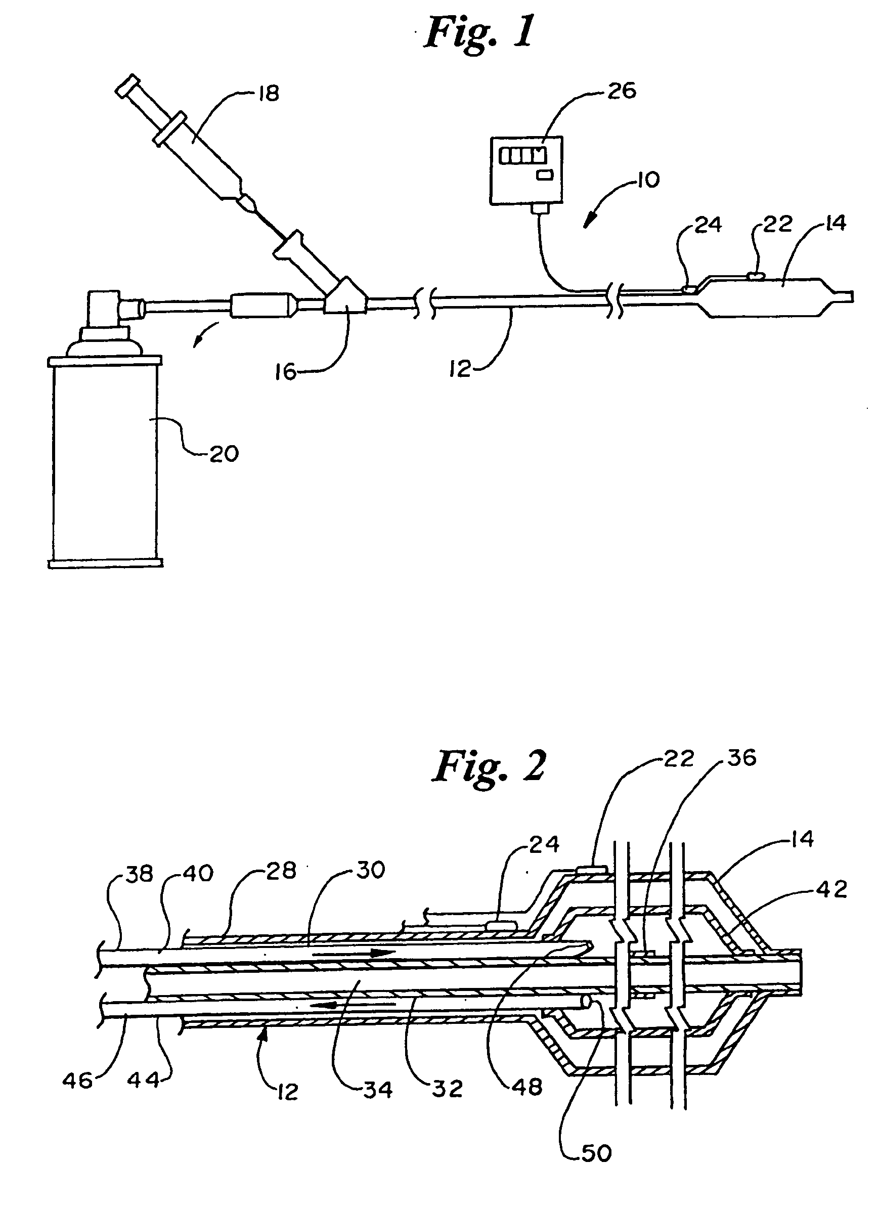 Cryoplasty device and method