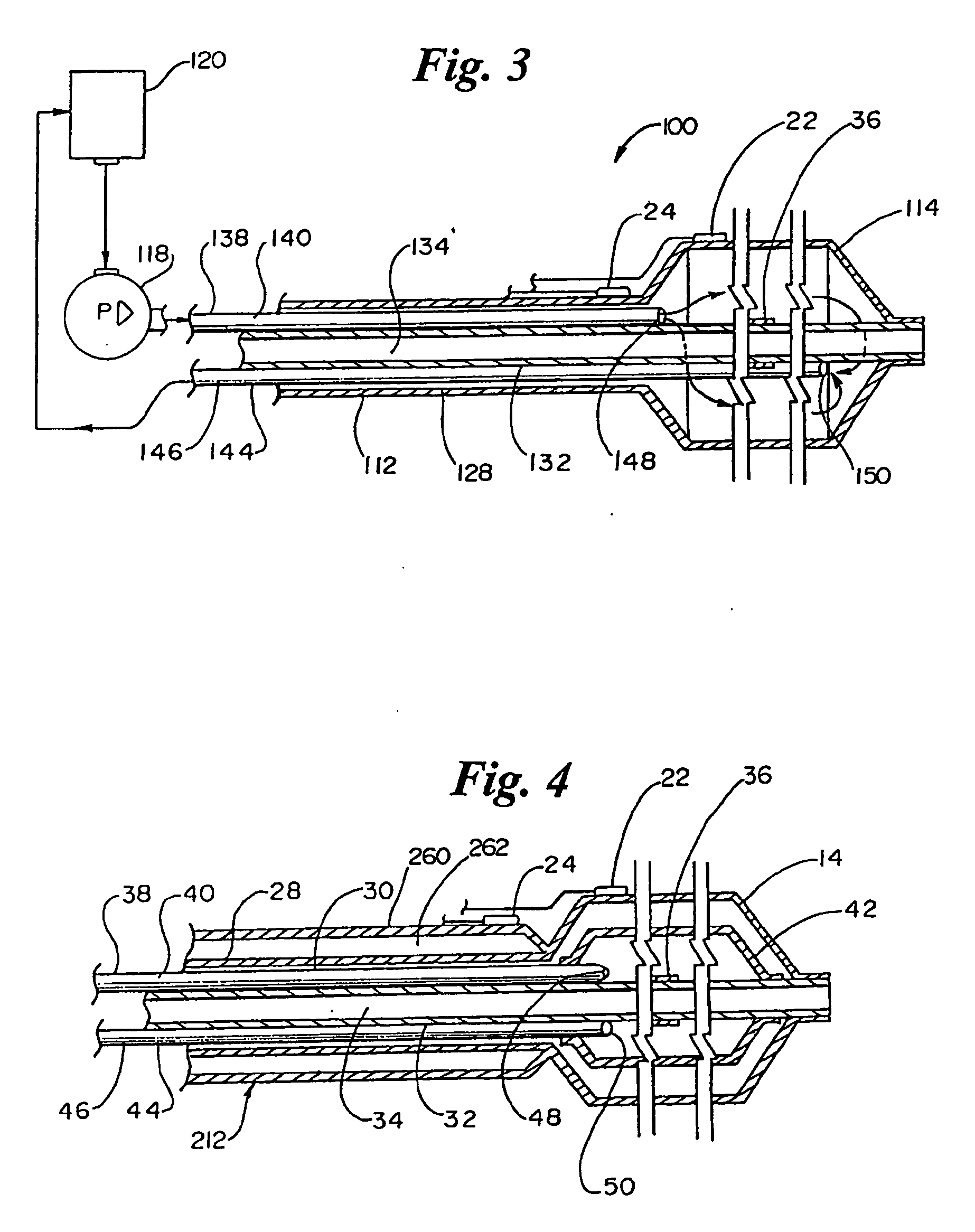 Cryoplasty device and method