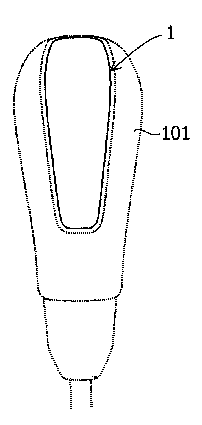 Molded plastic part