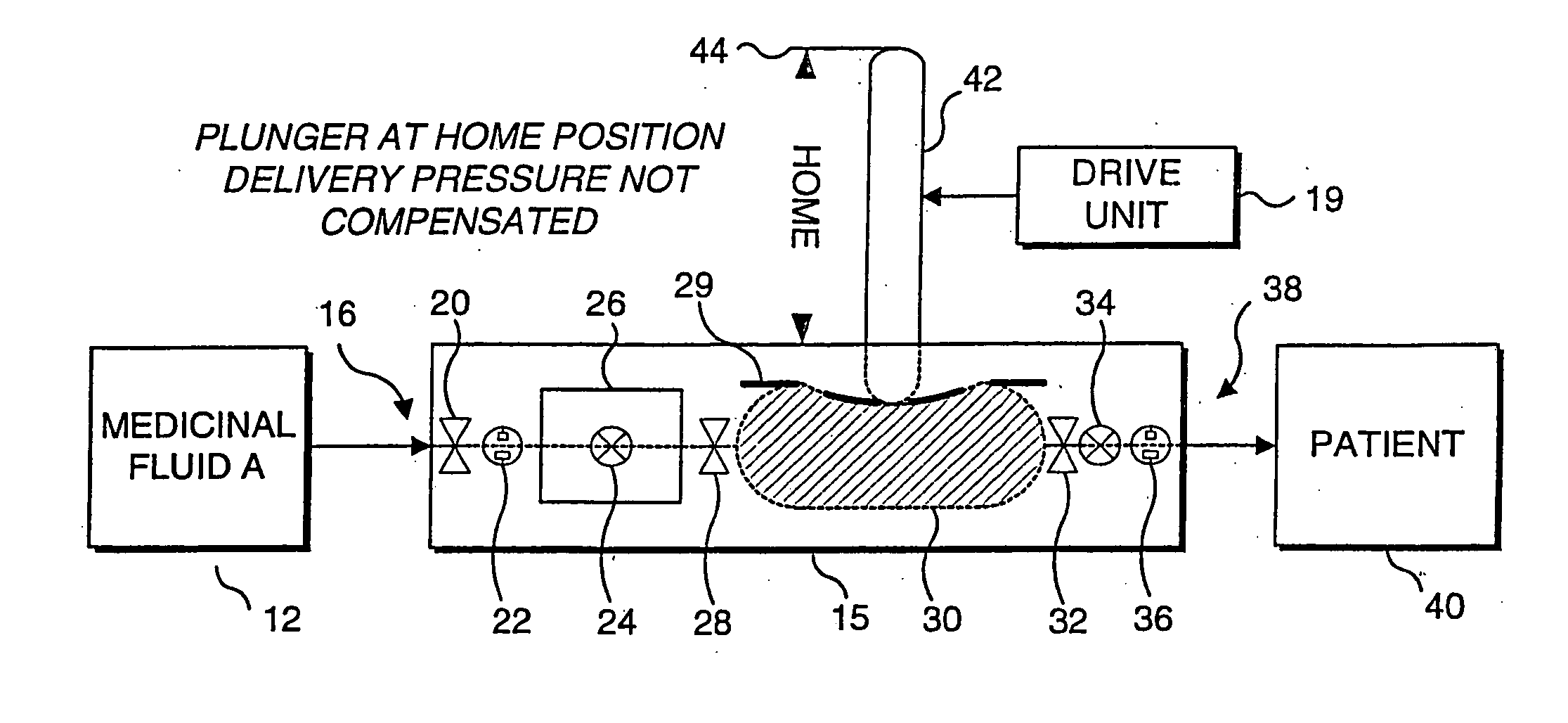 Methods for compensating for pressure differences across valves in IV pumps