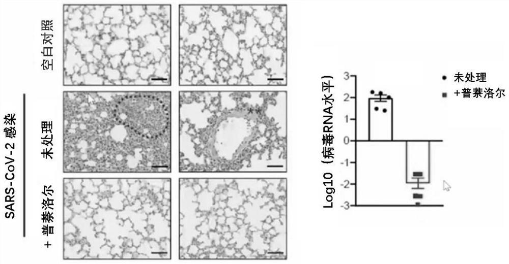 Application of propranolol in resisting coronavirus infection