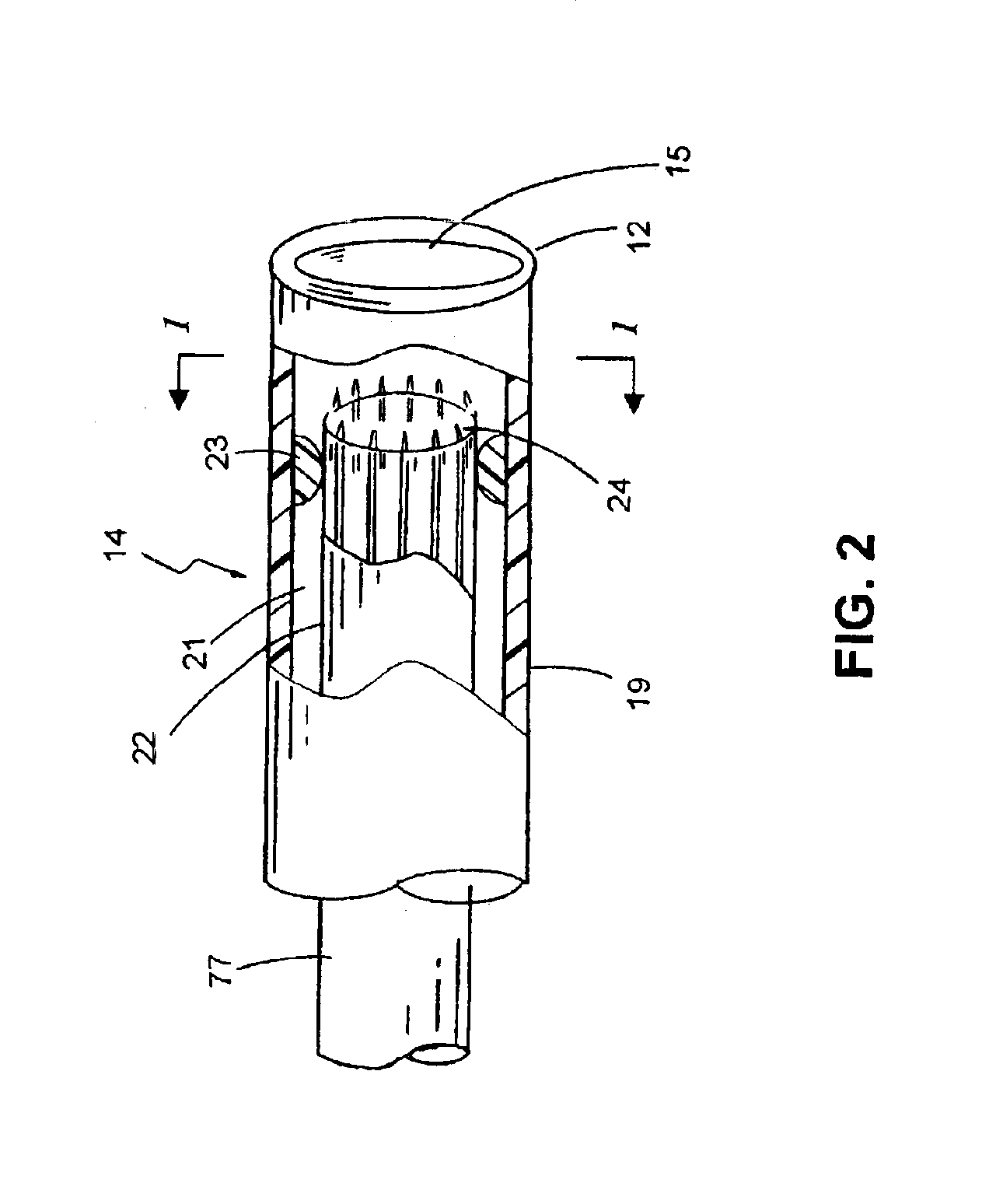 Apparatus and methods for valve removal