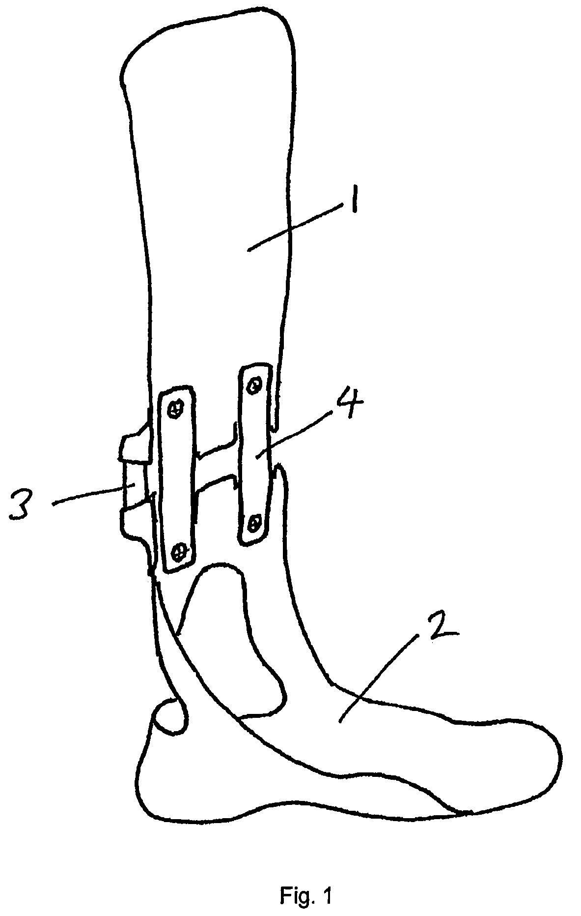 Articulated orthosis providing lift support