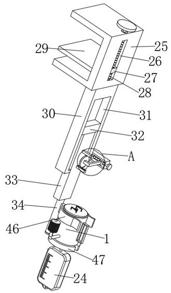 Urination observation device for kidney transplantation calculus