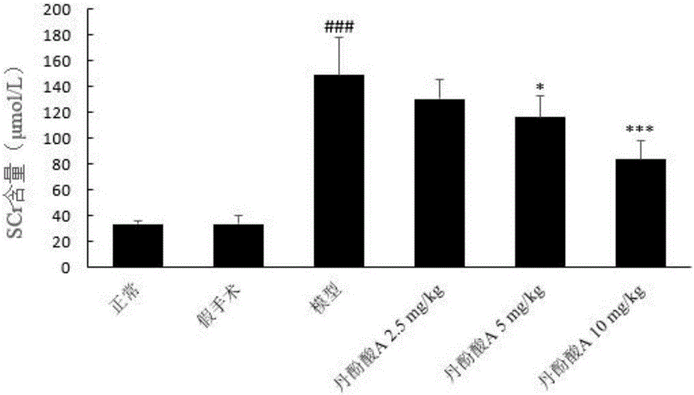 Application of salvianolic acid A in preparation of drugs for treating acute kidney injury