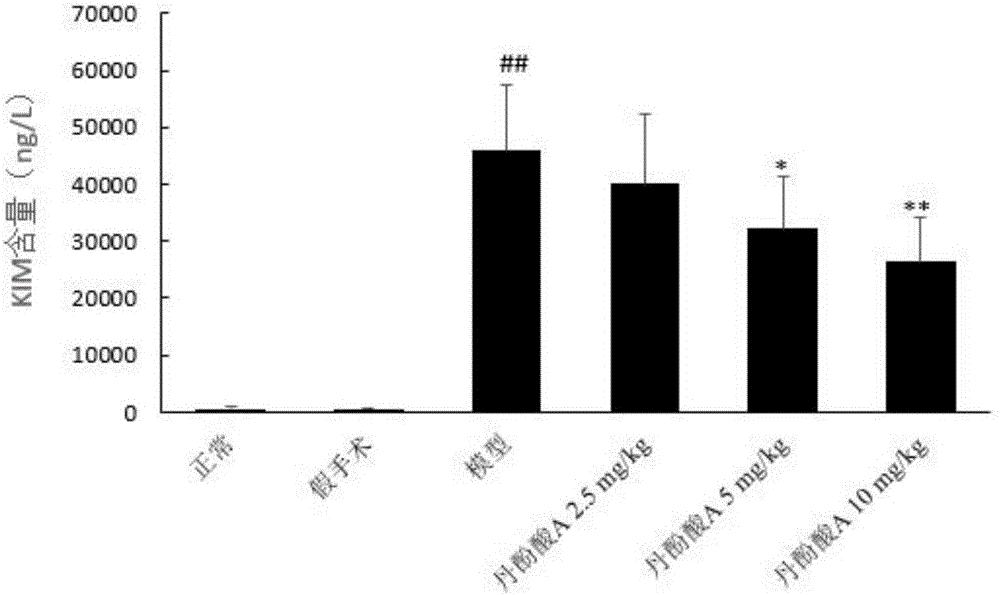 Application of salvianolic acid A in preparation of drugs for treating acute kidney injury