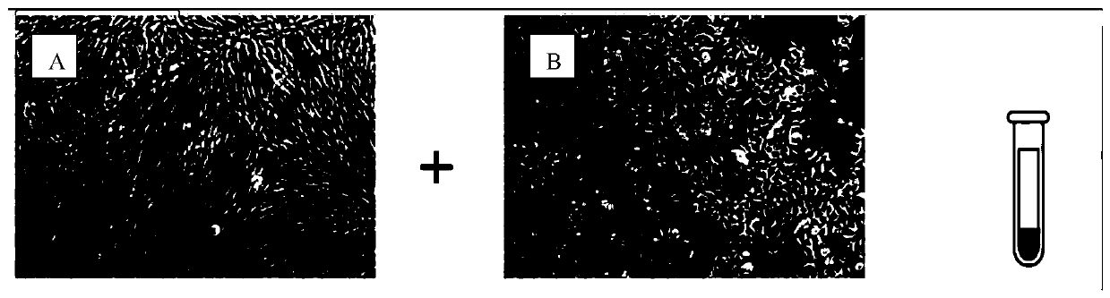 Preparation method of cell suspension for promoting hair regeneration and preventing alopecia